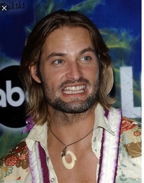 josh holloway teeth before and after